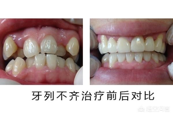 保山最新24小时牙医在线咨询方法分析(最方便真实的保山有没有24小时牙医方法)