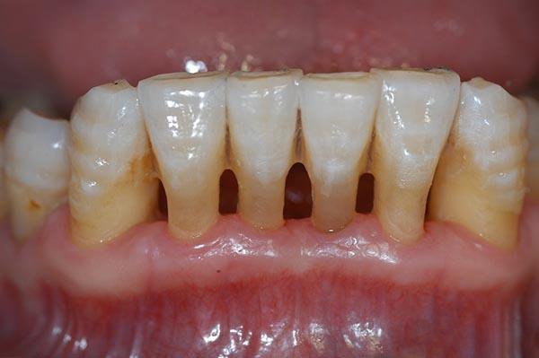 保山最新24小时牙医在线咨询方法分析(最方便真实的保山有没有24小时牙医方法)